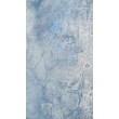 Frostbite